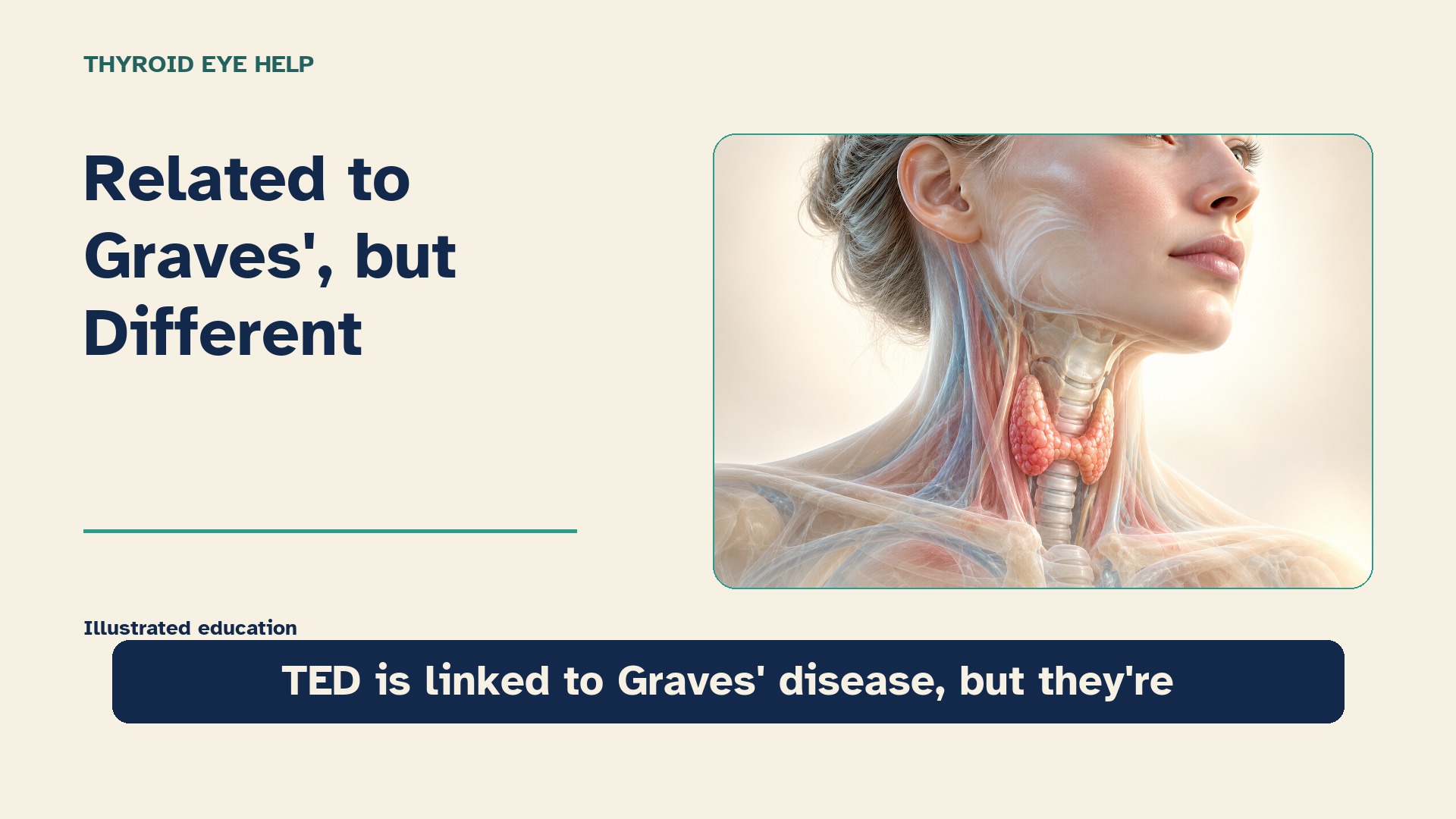 Normal thyroid levels and thyroid eye disease: an eye exam still matters — illustrated video