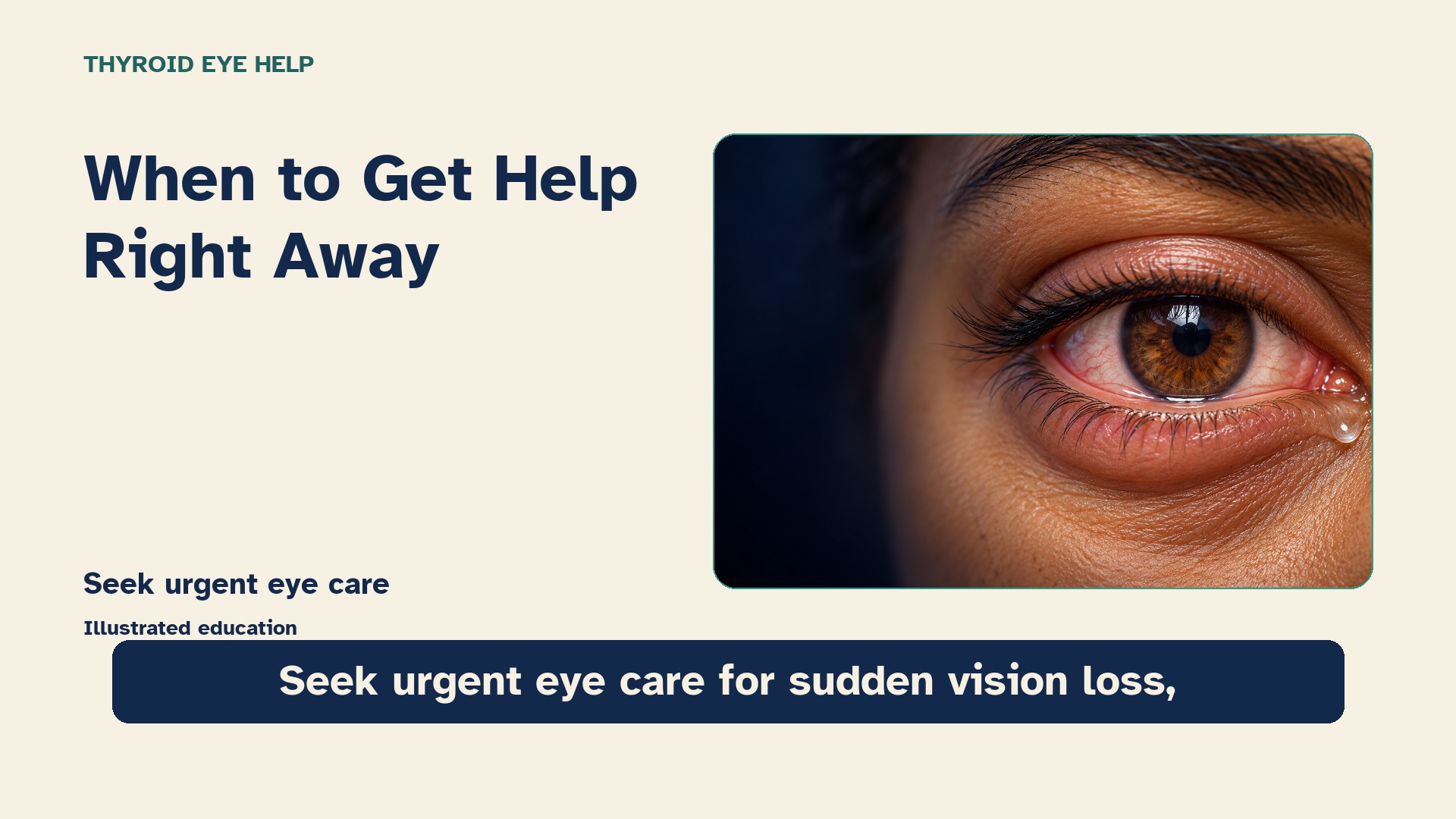 Eye symptoms that need urgent care — illustrated video